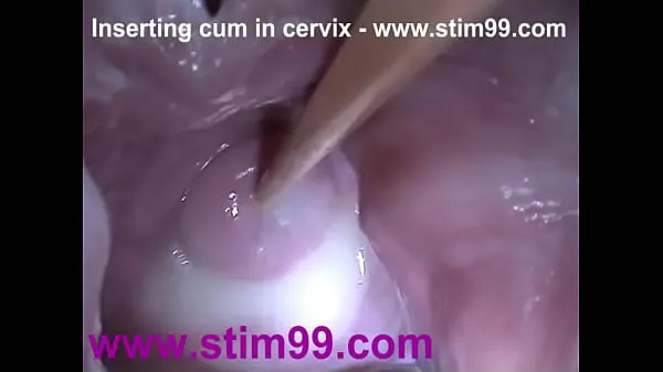 XXX Insertion Semen Cum in Cervix Wide Stretching Pussy Speculum varmt rør